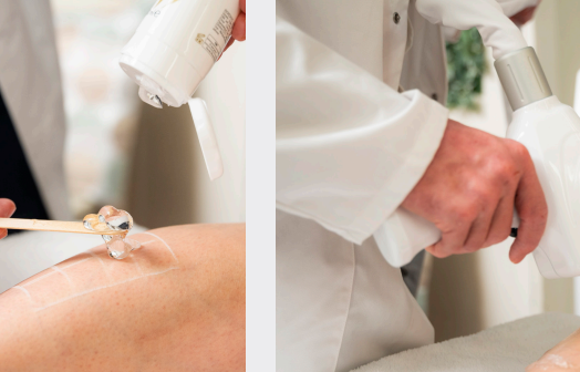 Laser Haarentfernung Wien 1010 Innere Stadt